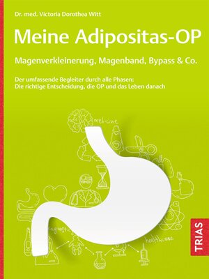 cover image of Meine Adipositas-OP. Magenverkleinerung, Magenband, Bypass & Co.